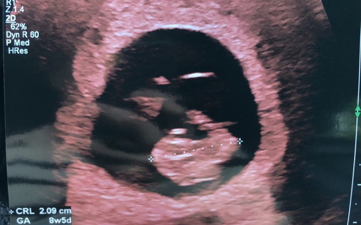 Zbiórka start dla mojego dziecka - zdjęcie główne