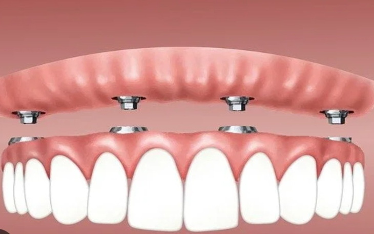 Zbiórka Leczenie stomatologiczneee - zdjęcie główne