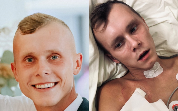 Zbiórka Rehabilitacja-Pomóżmy Hubertowi - zdjęcie główne