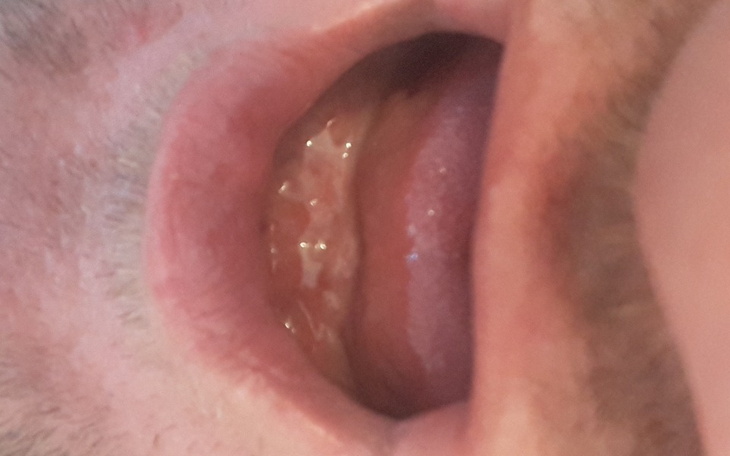 Zbiórka Proteza stała na implantach - zdjęcie główne