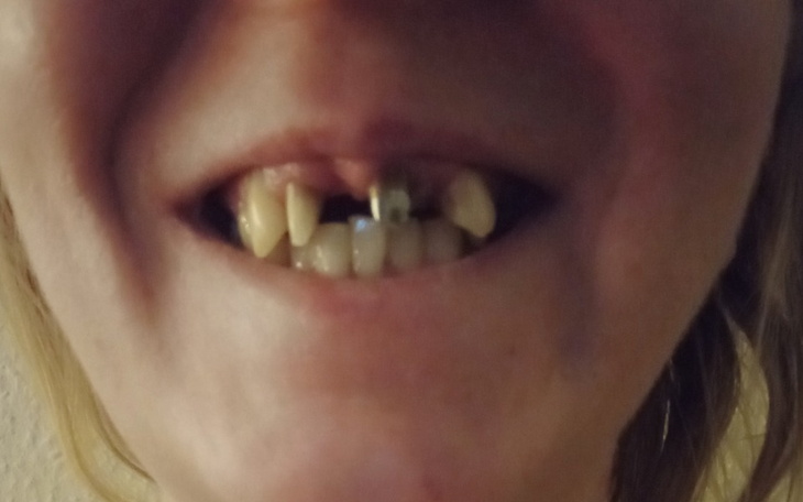 Zbiórka Na szczękę - zdjęcie główne