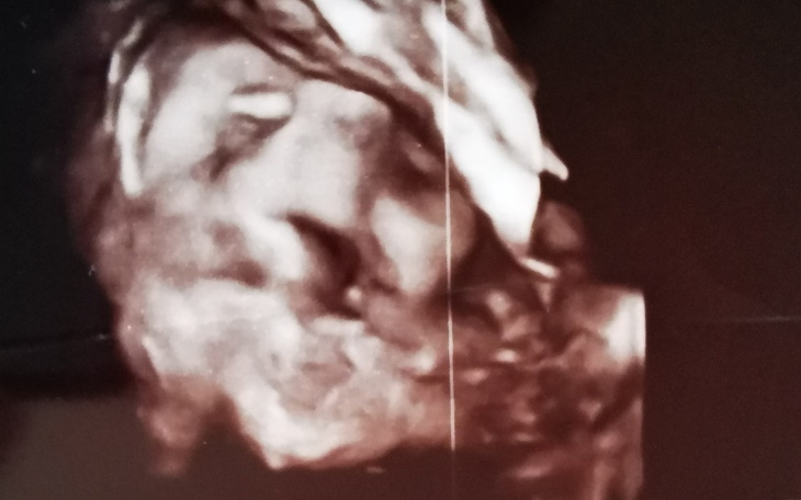 Zbiórka Pomoc od mamy i Oliwki dla taty - zdjęcie główne