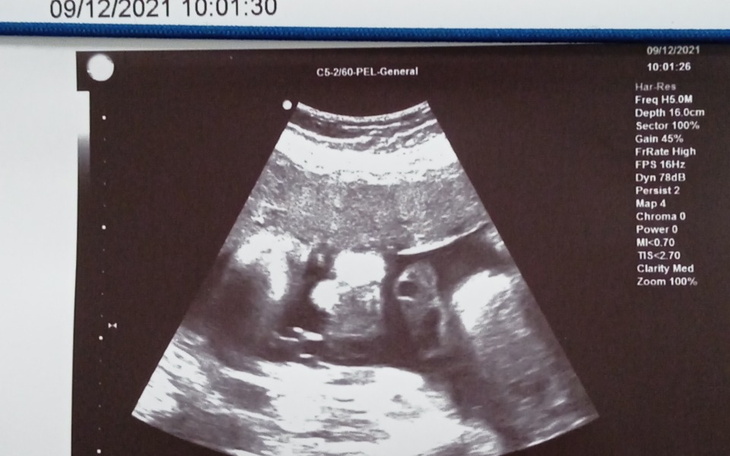 Zbiórka Kosmetyki i pampersy dla noworod - zdjęcie główne