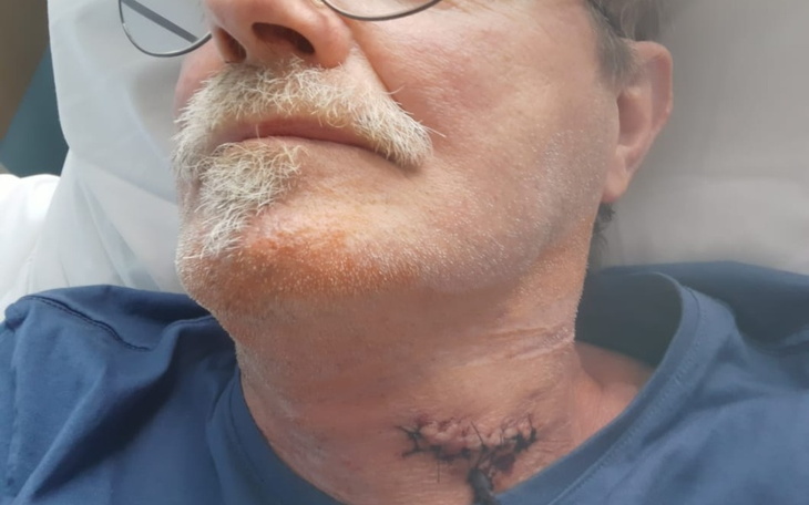 Zbiórka Leczenie pooperacyjne, rehabilit - zdjęcie główne