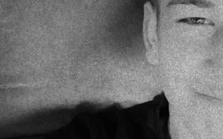 Zbiórka Nowotwór płuc - zdjęcie główne