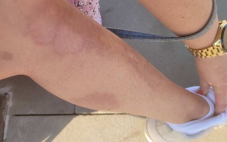 Zbiórka Na lekarzy i leczenie - zdjęcie główne