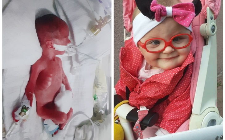 Zbiórka Rehabilitacja małej Inki - zdjęcie główne