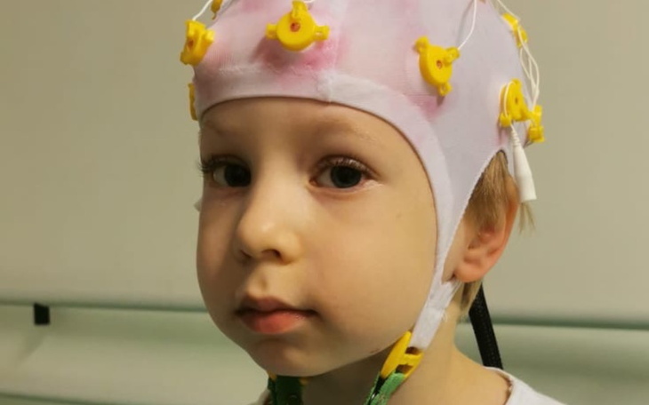 Dziecko w szpitalu z elektrodami na głowie, patrzące w obiektyw.