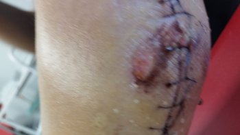 Zbiórka Adwokat dla skatowanego 18 latka - miniaturka zdjęcia