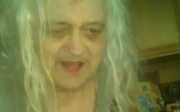 Zbiórka Na leczenie jaskry - zdjęcie główne