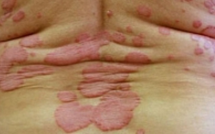 Zbiórka Pomóżcie zostało mi 2 lata życia - zdjęcie główne