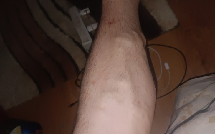 Zbiórka Zbieram na operacje zylaki bo mn - zdjęcie główne