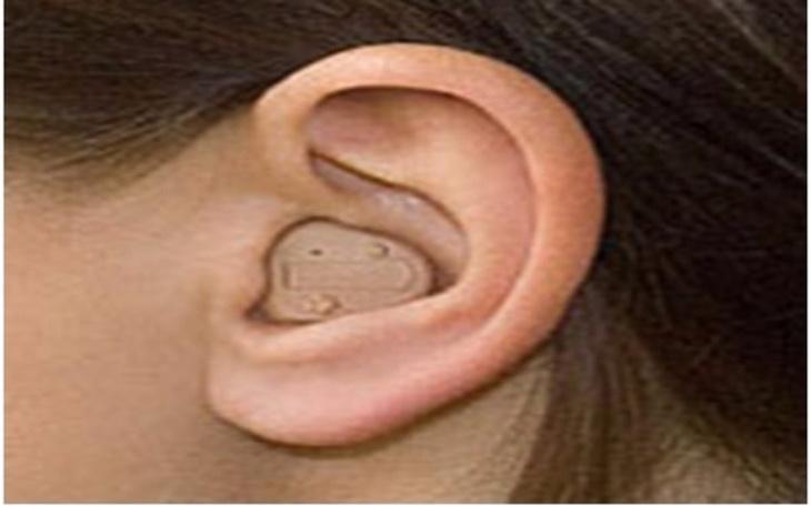 Zbiórka Aparat sluchowy - zdjęcie główne