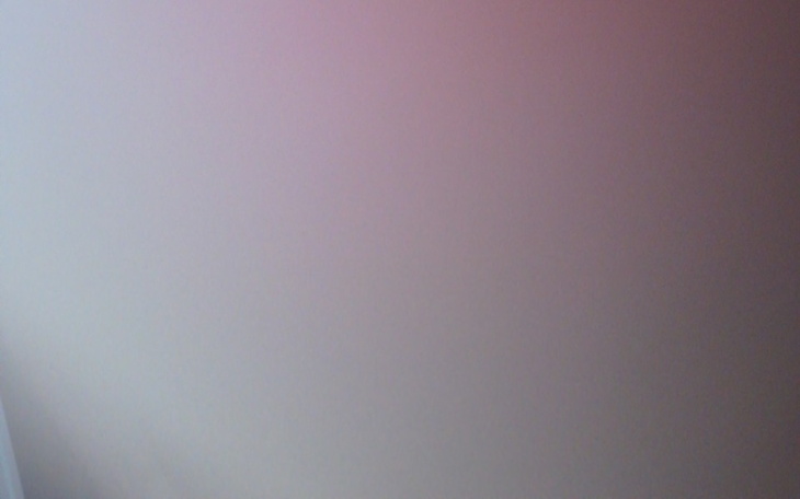 Zbiórka Przeszczep włosów dla Rudego - zdjęcie główne