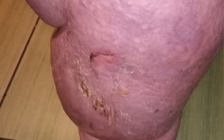 Zbiórka Moja mama cierpi - zdjęcie główne