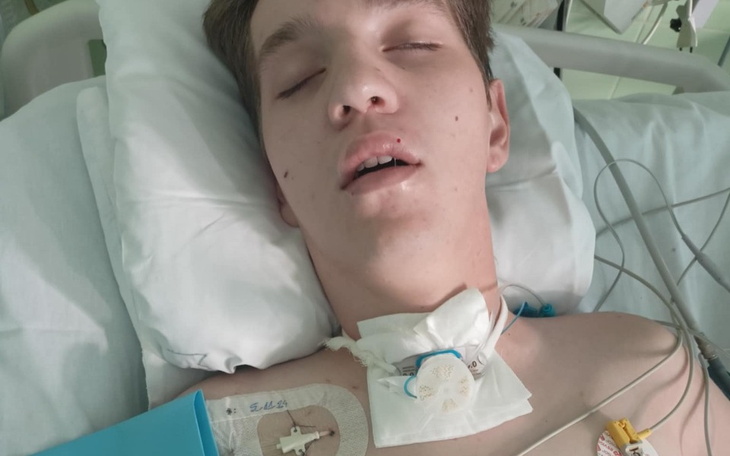 Młody chłopak leży w szpitalu, z podłączonymi urządzeniami medycznymi.