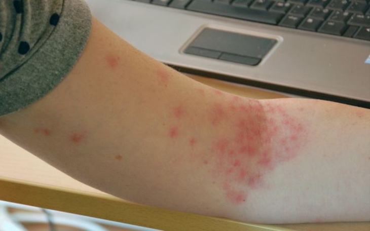 Zbiórka Na leki dla Pawła - zdjęcie główne