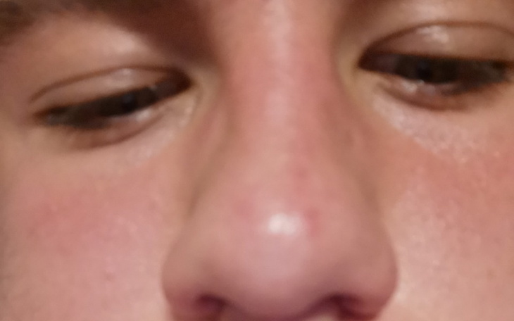 Zbiórka Na 3 kebaby - zdjęcie główne