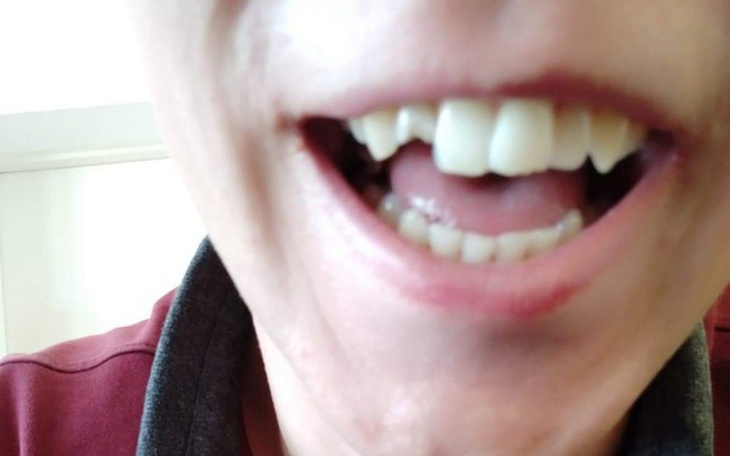 Zbiórka Na dorobienie zęba dla Karola - zdjęcie główne