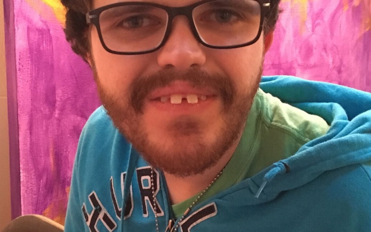 Zbiórka Elden Ring - zdjęcie główne