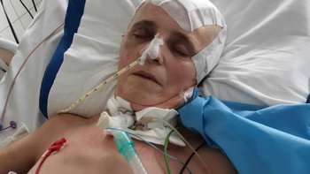 Zbiórka Zosia potrzebuje pilnej pomocy - miniaturka zdjęcia