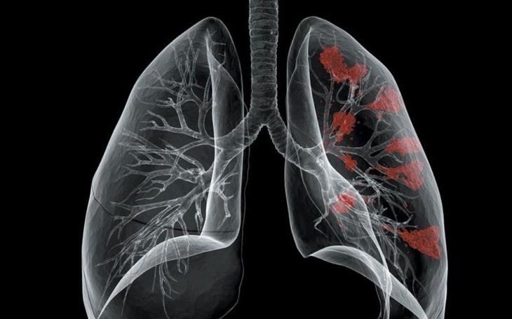 Zbiórka Dla taty na walkę z rakiem - zdjęcie główne