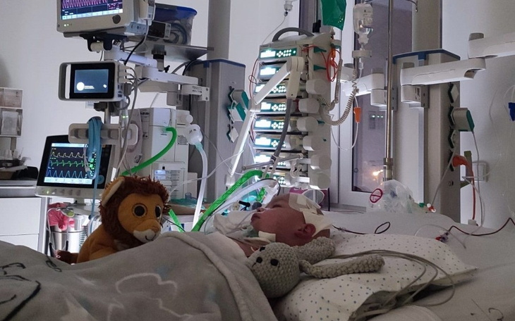 Dziecko w szpitalu z pluszakami obok.