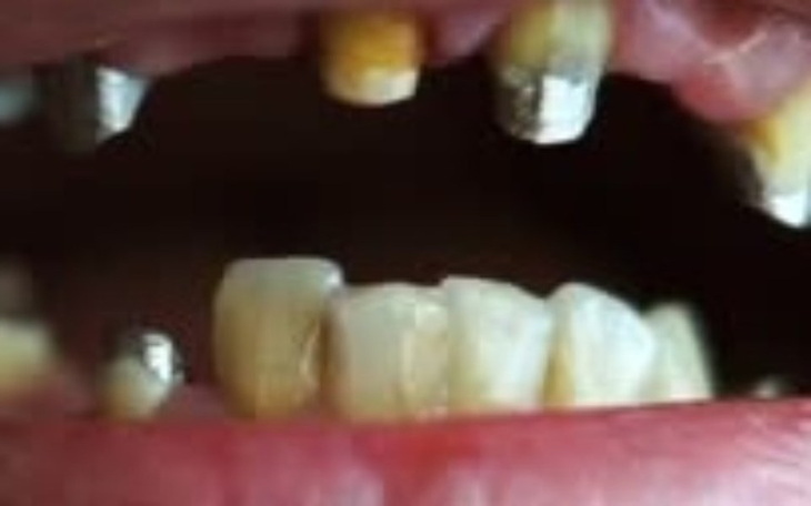 Zbiórka Piętno i kara - błagam o zęby - zdjęcie główne