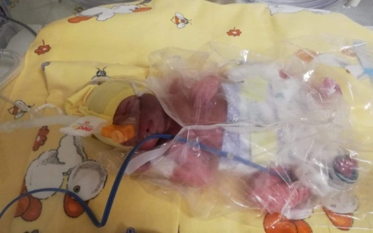 Noworodek w inkubatorze, z rurkami do podtrzymania życia.