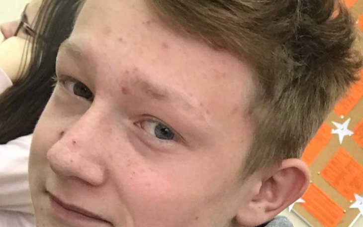 Zbiórka Nowa stopa Mateusza - zdjęcie główne