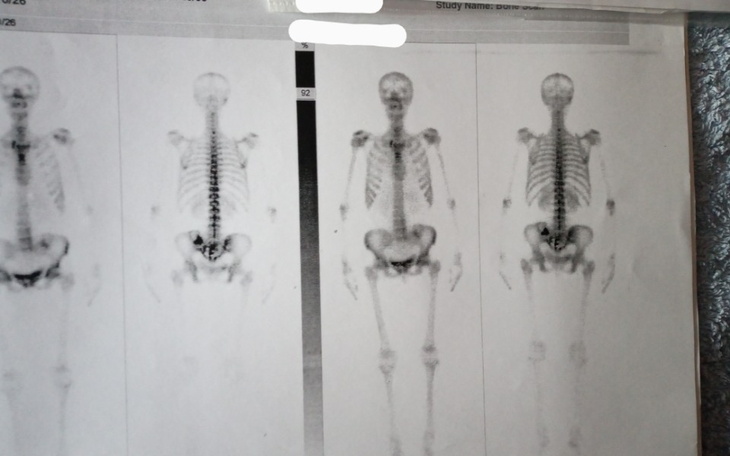 Zbiórka Pomoc mamie w walce z nowotworem - zdjęcie główne