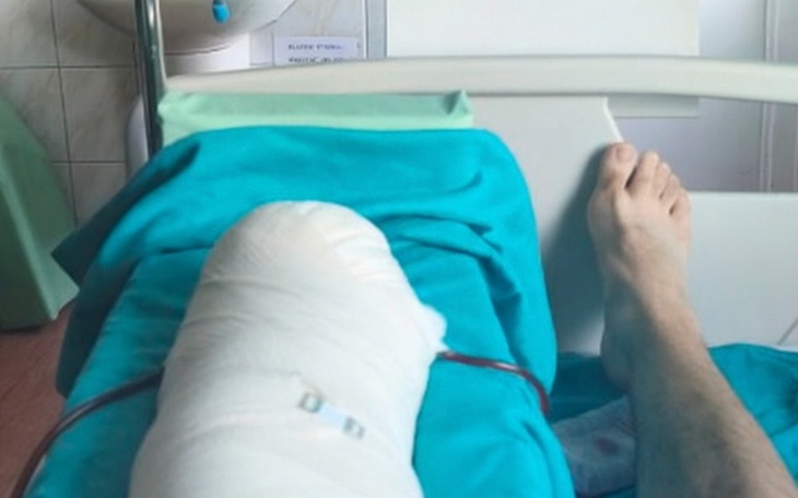 Osoba w szpitalu z opatrunkiem na nodze.
