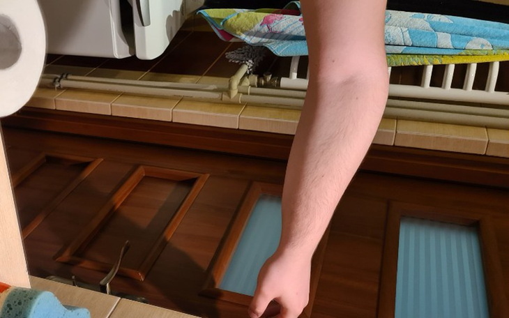 Zbiórka Korekta kształtu ręki - zdjęcie główne