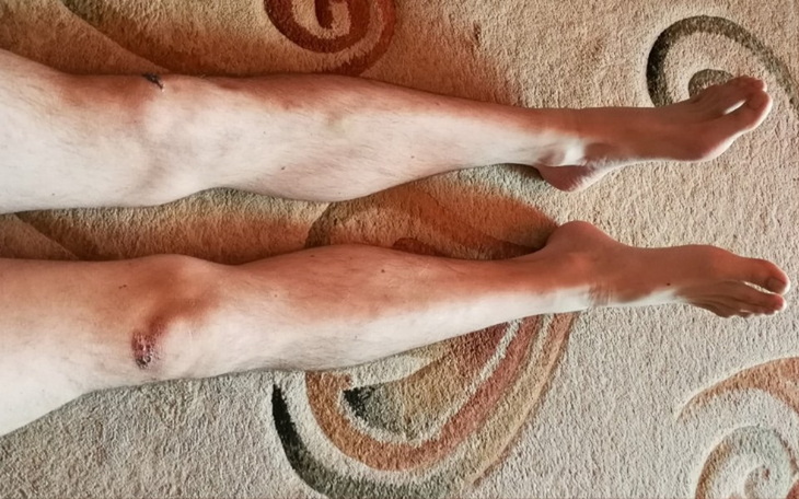 Zbiórka Rekonwalescencja powypadkowa ! - zdjęcie główne