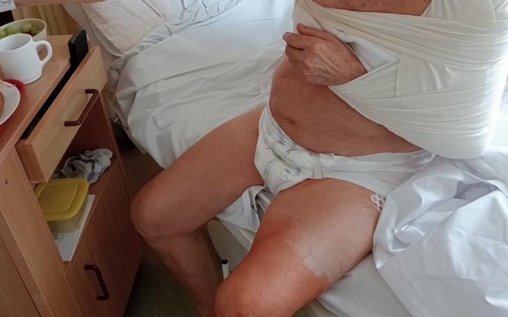 Osoba w szpitalu, z opatrunkiem na ramieniu, siedząca na łóżku.