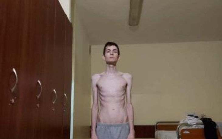 Zbiórka Anoreksja - wygrać z chorobą - zdjęcie główne