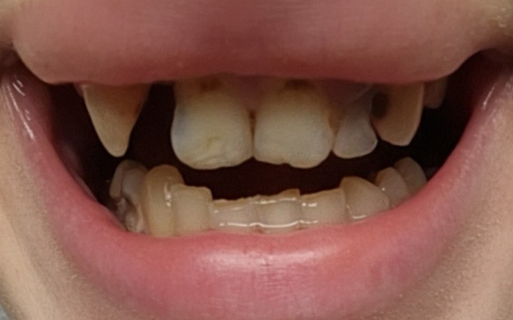 Butelka szamponu Healpsorin na białym tle.