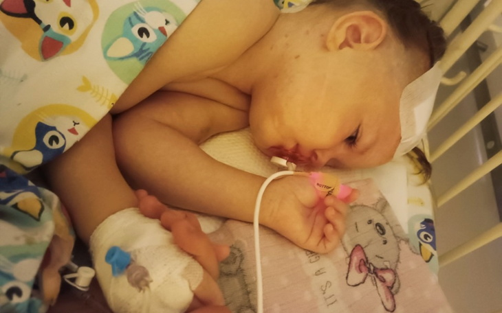 Małe dziecko w szpitalu, z opaską na głowie i kroplówką.