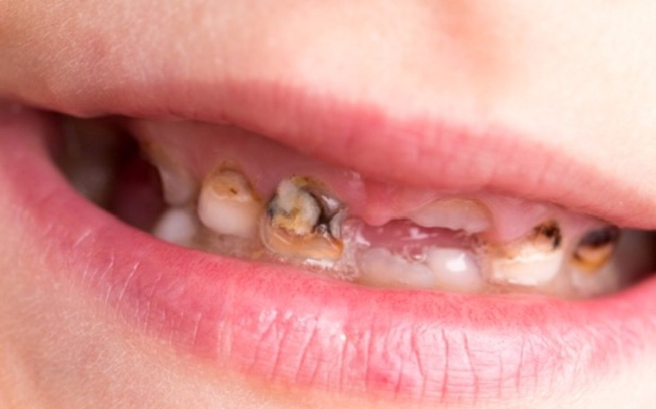 Zbiórka Leczenie zębów syna pod narkozą. - zdjęcie główne