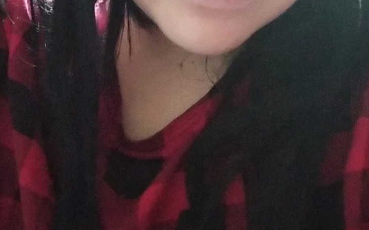 Zbiórka Labioplastyka - zdjęcie główne