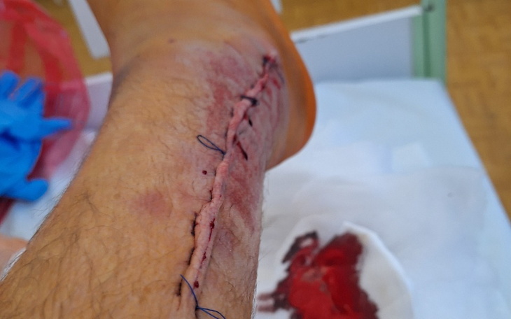 Zbiórka Pomoc dla Syna po wypadku w DE - zdjęcie główne