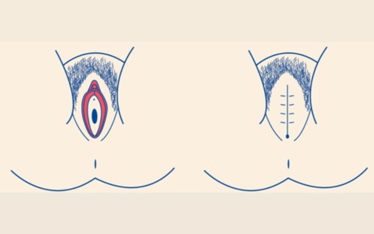 Ilustracja przedstawiająca różne kształty ciała.