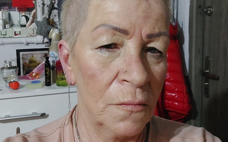 Zbiórka e rechabilitacja tomogrsf serce - zdjęcie główne