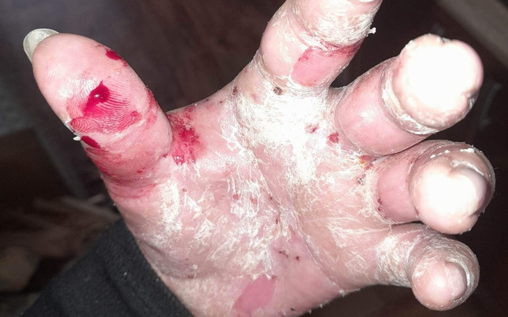 Zbiórka By żyć bez bólu - zdjęcie główne