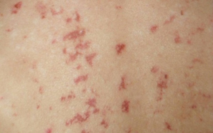 Zbiórka Pomóż w walce z chorobą - zdjęcie główne