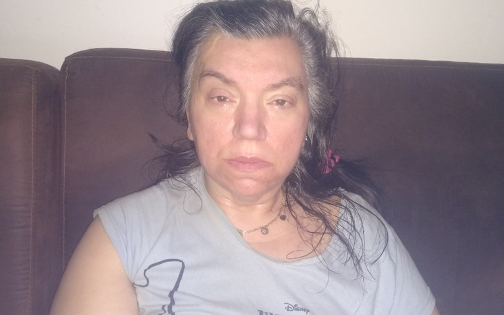 Zbiórka Rehabilitacja po darze mózgu - zdjęcie główne