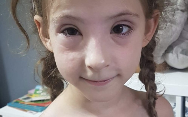 Zbiórka Zakręcona misja na rzecz WZW B - zdjęcie główne