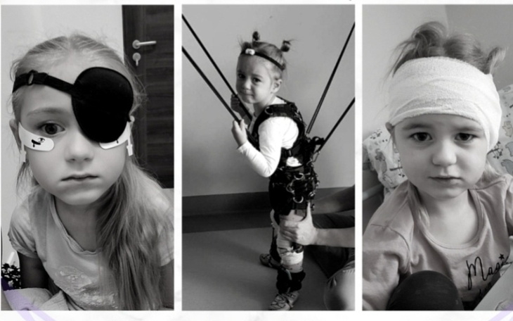 Dziewczynka w szpitalu z opatrunkami na głowie.