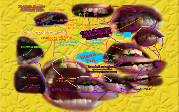 Zbiórka Zęby,Tusza,Jelita,Serce,Dług,Dom - zdjęcie główne