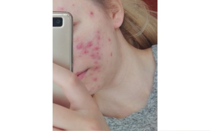 Zbiórka Aby znów uwierzyć w siebie - zdjęcie główne